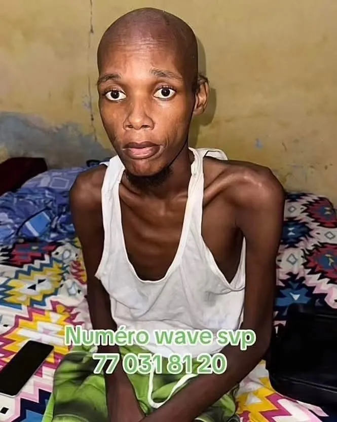 Samba Yoro, amputé d&rsquo;une jambe, lance un appel à l&rsquo;aide face à des douleurs persistantes