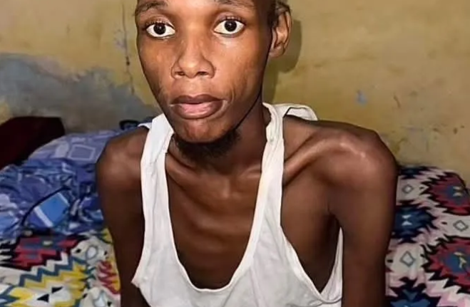 Samba Yoro, amputé de la jambe et gravement malade, lutte pour sa vie dans l’indifférence (photo)