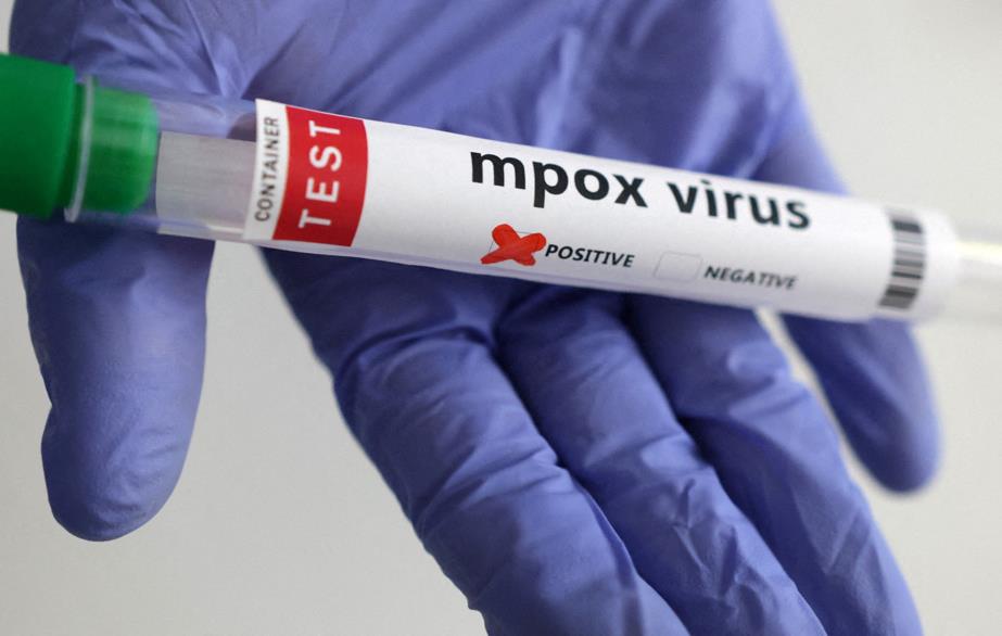 Le cas importé de Mpox est désormais guéri