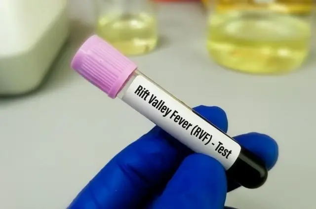 10 cas de fièvre de la vallée du Rift et 337 cas de dengue recensés