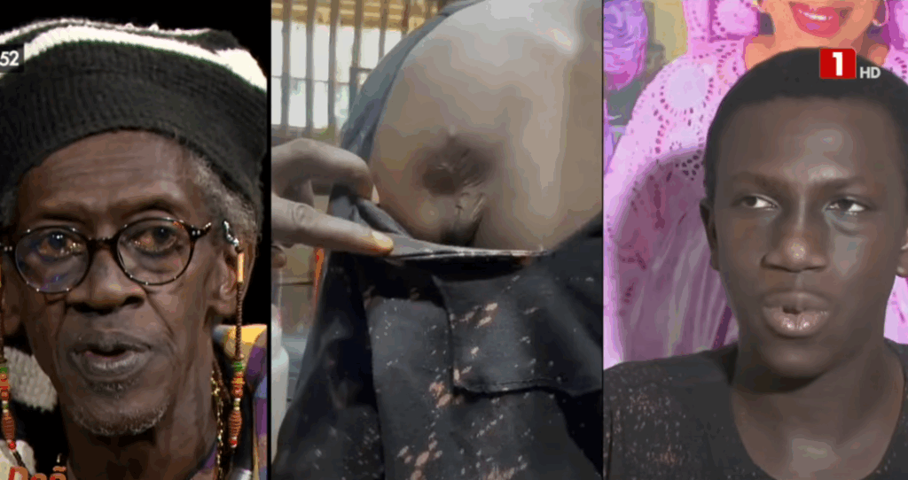 Victime d’une balle en pleine épaule, le fils de Cheikh Lo raconte sa mésaventure lors des événements de 2021 à 2024…