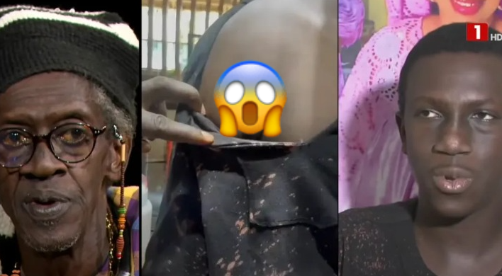 « J&rsquo;ai reçu une balle en pleine épaule lors des manifestations » (photo)