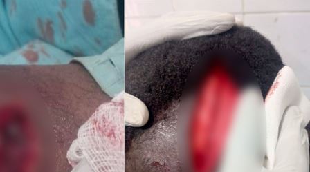 un enseignant coranique attaqué à la machette…