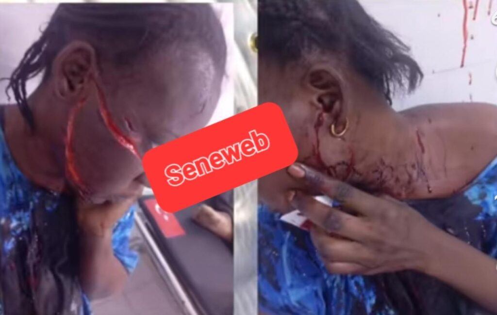 une infirmière d’État envoyée en prison pour avoir lacéré le visage de sa coépouse