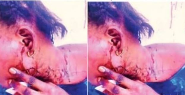 une infirmière d’État accusée d’agression sur sa coépouse…