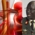 “Même sous dialyse, on peut vivre plus de 40 ans”, selon le Pr Abdou Niang