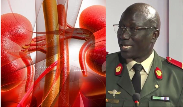 “Même sous dialyse, on peut vivre plus de 40 ans”, selon le Pr Abdou Niang