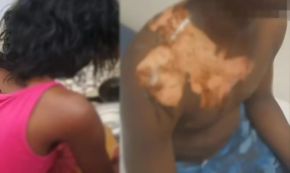 Ross-Béthio : une femme verse de l’eau bouillante sur son mari et sa coépouse